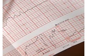 EKG-Karten / EKG-Mappen